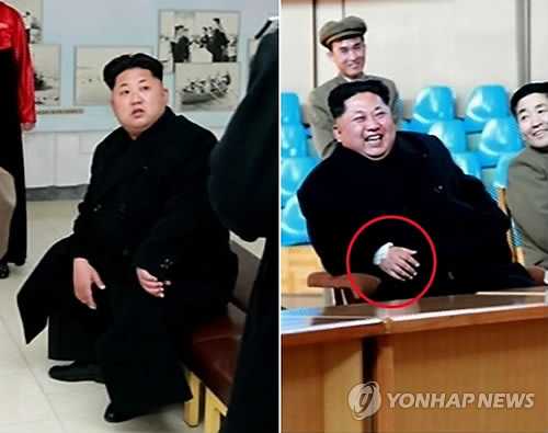 Hình ảnh ông Kim hôm 4/4 (trái) và hôm 8/4 (phải) trên KCNA cho thấy có sự khác biệt trên cổ tay phải của ông