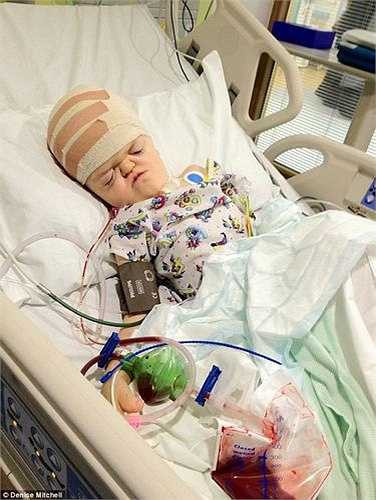 Mẹ của Billy, cô Denise Mitchell, 47 tuổi, nói rằng mình đã linh cảm có một cái gì đó đã xảy ra với con trai của mình khi Billy được sinh ra. ‘Tôi nhận thấy các ngón tay và ngón chân của Billy như dính lại với nhau’.