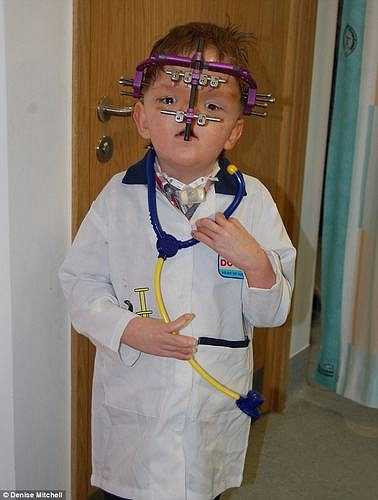 Apert là một bệnh về di truyền gây ra bởi một khiếm khuyết nhiễm sắc thể. Trẻ bị Apert thường có dấu hiệu: mặt trố, xương hàm biến dạng, hở hàm ếch, các ngón chân tay có màng.