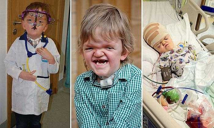 Năm may, Billy đã 7 tuổi và cậu bé đã trải qua hơn 50 cuộc phẫu thuật lớn nhỏ để tìm lại khuôn mặt mình. 