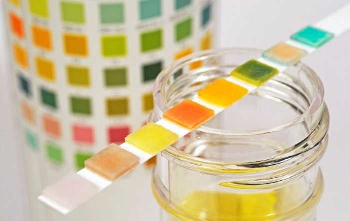 8. Nước tiểu sủi bọt: Khi gặp phải dấu hiệu này, bạn có nguy cơ mắc bệnh thận cao. Khi thận không hoạt động đúng cách, có thể dẫn đến sự tích tụ protein trong nước tiểu tạo ra bọt khí khi nó tiếp xúc với nước trong nhà vệ sinh. 