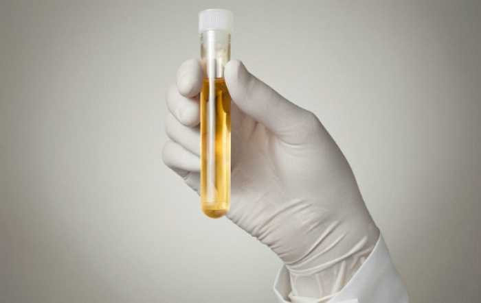 9. Tăng số lần đi tiểu: Đây là dấu hiệu cảnh báo về bệnh phì đại tuyến tiền liệt hay còn gọi là u tuyến tiền liệt lành tính. 