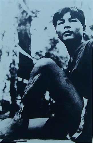 Trong ảnh là đồng chí Trịnh Văn Thanh, đã bị chúng đục bánh chè, rồi cưa chân để khỏi vượt ngục.