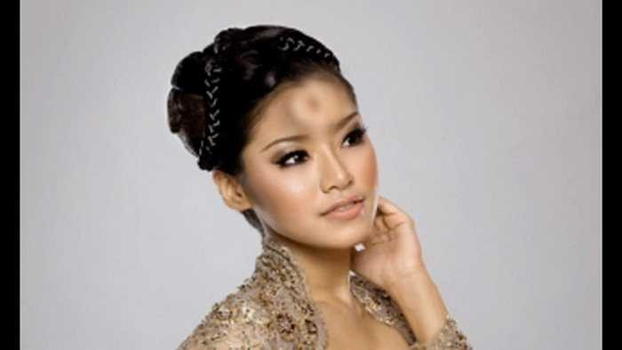 8. Vầng trán bánh vòng. Đây được cho là một trong những xu hướng làm đẹp hot dành cho phụ nữ Nhật Bản. Các bác sỹ sẽ bơm vào trán của người phụ nữ các muối hóa học để tạo ra vùng trán giống như chiếc bánh vòng. Vào sáng hôm sau, cơ thể người sẽ hấp thụ các chất này và vùng trán trở lại bình thường