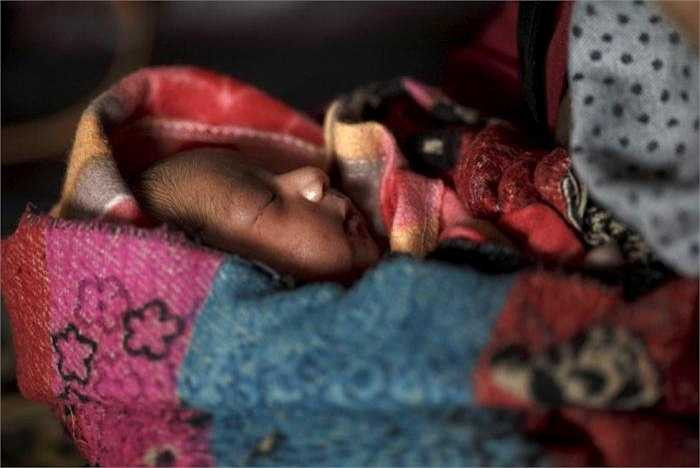 Một trẻ sơ sinh 4 ngày tuổi trong bẹnh viện.