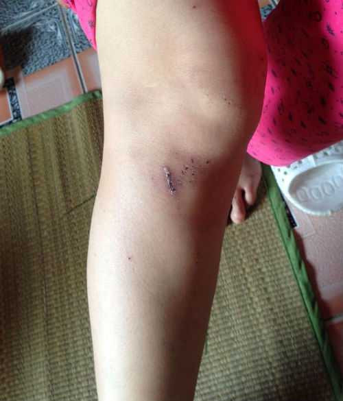 Người phụ nữ tố cáo bị cả nhà hàng xóm xé quần, trói chặt tay chân