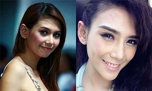 Hoàng Yến cũng không thoát khỏi nghi vấn dao kéo vì chiếc cằm dài bất thường.
