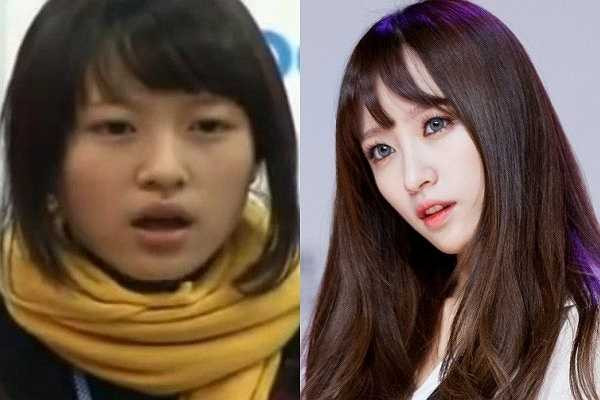 Là gương mặt đang được chú ý, quá khứ của Hani (EXID) luôn khiến cả cộng đồng Kpop quan tâm. Mới đây, đoạn clip Hani thi tuyển vào JYP bị lật lại và nhan sắc thời điểm 16 tuổi của cô trở thành đề tài bình luận sôi nổi. Một vài cư dân mạng nhận xét vẻ ngoài Hani quá đỗi tầm thường và đặt ra nghi vấn 'dao kéo; đối với nữ thần tượng.