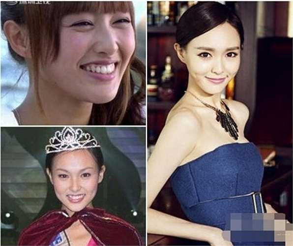 Hiện nay, cô đẹp hơn và ngày càng nổi tiếng. Chính vì sự khác biệt này, Đường Yên bị nghi vấn đã thẩm mỹ chỉnh răng và mắt. 