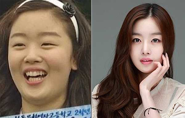 Han Sun Hwa là trường hợp đại diện cho việc thay đổi toàn diện khi bước chân vào làng giải trí. Ít ai ngờ một cô nàng quê mùa lại lột xác thành hot girl quyến rũ như hiện nay. Dù Han Sun Hwa không thừa nhận nhưng nhiều ý kiến cho rằng thành viên Secret đã chỉnh sửa mắt, mũi, răng, cằm và gọt mặt.