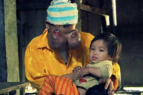 Đau xé lòng: 'Bà quái vật ơi, đừng chết!'