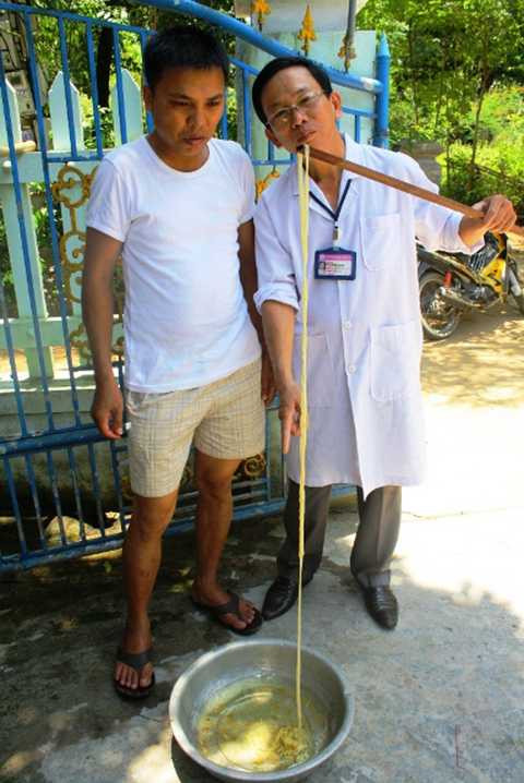 rùng mình, sán xơ-mít, dài 12m, làm tổ, khủng, đàn ông, Quảng Trị