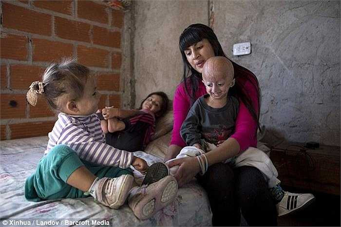 Người mắc bệnh Progeria thường chết vì bệnh tim mạch hoặc đột quỵ ở độ tuổi trung bình là 13 tuổi. Hiện tại trên thế giới có khoảng 74 trường hợp mắc phải căn bệnh này.