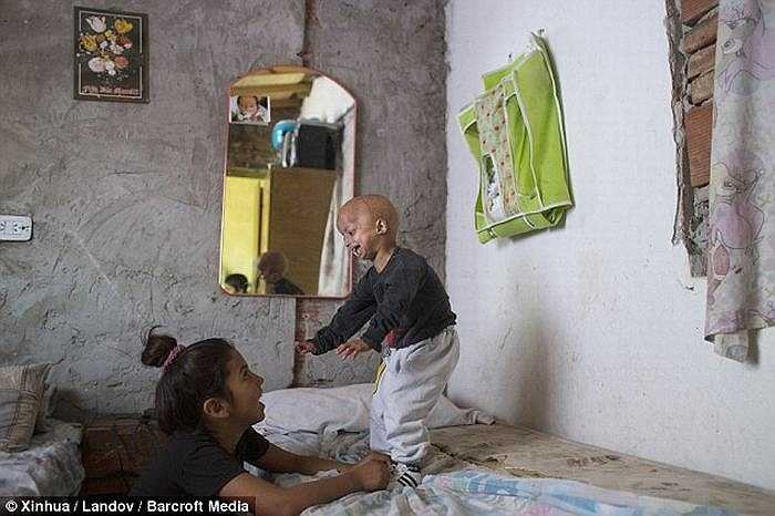 Dù ngoại hình trông giống như một cụ già nhưng Franco rất thích xem phim hoạt hình và chơi đùa với các anh chị em của mình.