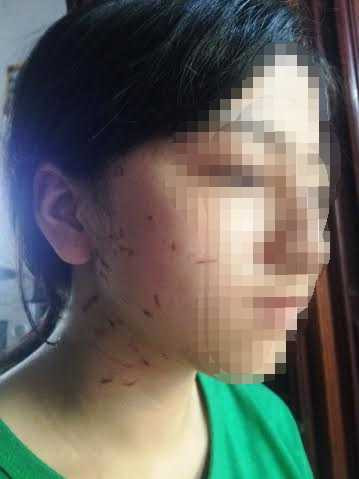 Đình chỉ học nữ sinh xé áo, hành hung bạn dã man