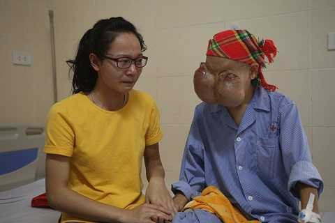 Người phụ nữ có đôi mắt như sắp nổ tung giờ ra sao?