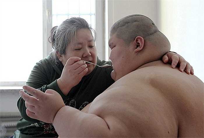 Người anh trong cặp song sinh bị bại não và béo phì, nặng 250kg và không thể di chuyển