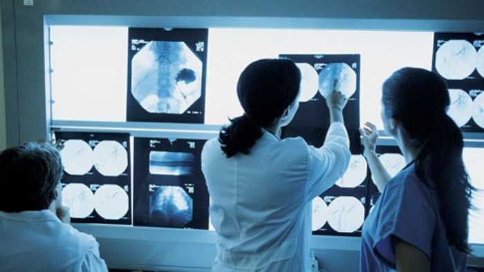 Năm 1833, Chủ tịch Hiệp hội hoàng gia Anh, Sir William Thomson đưa ra tiên đoán 'trật lất' đó là 'X quang chỉ là trò bịp'.