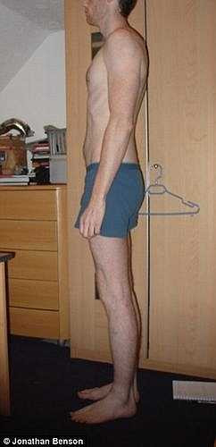 Năm đó, Jonathan mới 20 tuổi. Bác sỹ yêu cầu là anh nên hạn chế đi lại và làm việc quá sức. 