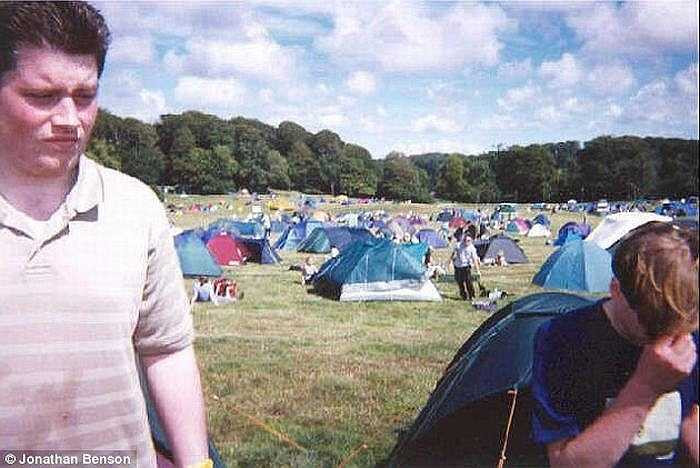 Jonathan quyết định chia sẻ câu chuyện của mình để những người mắc bệnh giống anh không phải phẫu thuật.