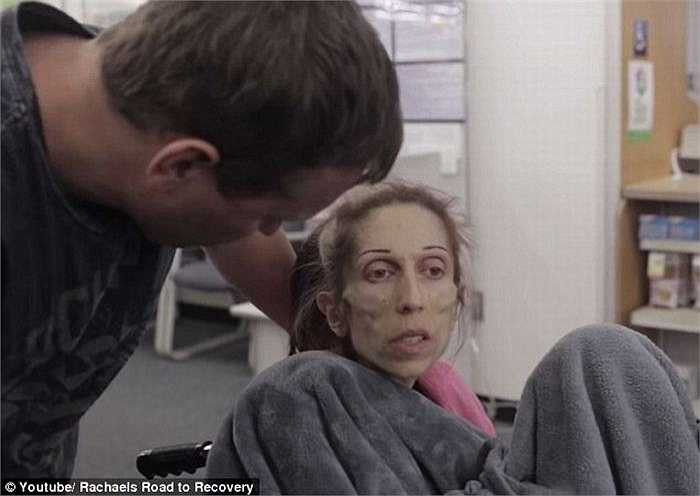 Hiện tại bệnh của Rachael Farrokh càng nguy kịch, sức khỏe giảm rõ rệt, hơi thở cũng yếu đi, và không thể đi ra khỏi nhà. Các bệnh viện địa phương đã từ chối tiếp tục điều trị cho cô vì không còn hy vọng . 