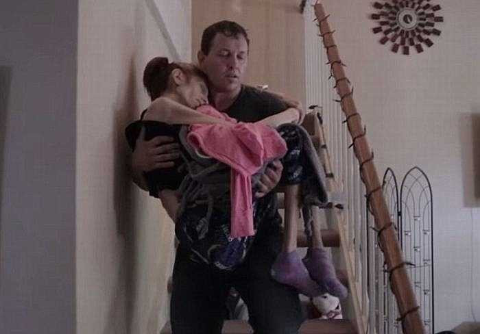 Trước đó, cặp đôi này gặp nhau khi Rachael chưa mắc bệnh, vẫn xinh đẹp, hoạt bát và khoẻ mạnh. Lúc đó, Ron đang là huấn luyện viên tại một phòng tập gym.