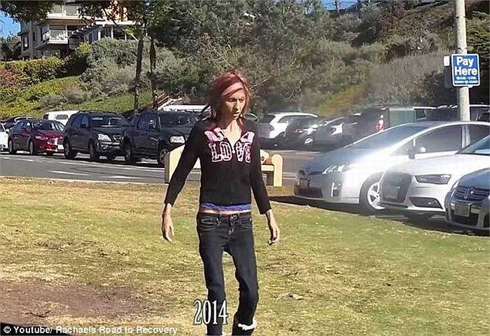 Rod chia sẻ rằng vợ anh cần được điều trị đặc biệt và hiện chỉ có duy nhất một bệnh viện ở Mỹ chuyên chữa trị cho người mắc bệnh này bởi nó rất khó xử lý. 