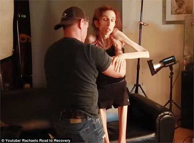 Rod và Rachael đang phải nhờ cậy đến sự giúp đỡ của cộng đồng khi phải chống chọi với căn bệnh biếng ăn. 