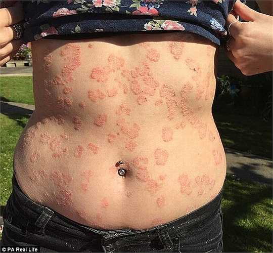 Từ đó, Emma khép mình sau lớp trang điểm và những bộ trang phục che kín toàn thân. Cô sống khép kín, ngại tiếp xúc với mọi người, đặc biệt nam giới. 