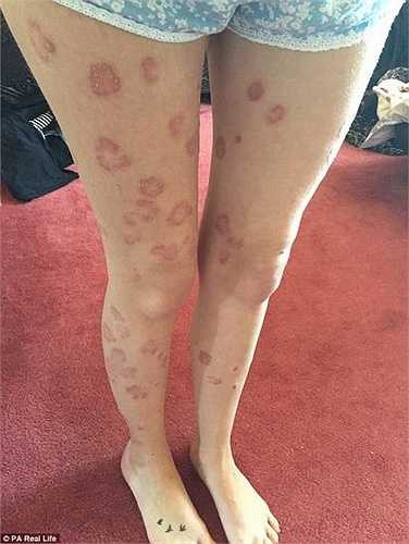 Vào 11/2014, khi bắt đầu hẹn hò với Matthew Rose (một đồng nghiệp cũ), Emma đã lấy lại được niềm vui trong cuộc sống và cảm thấy tự tin hơn. 