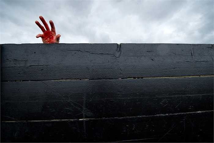 Một bàn tay hóa trang đầy máu ở Saffron Walden, Anh