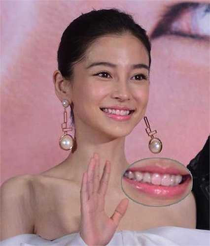 Người đẹp Angelababy mắc lỗi khi để son dính vào răng, làm cho nụ cười của cô không còn hấp dẫn