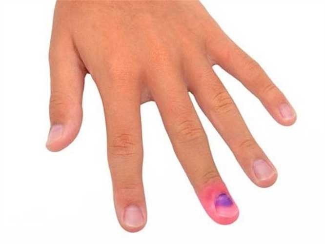 Da tay có những đốm nâu, hoặc đỏ: Đây là dấu hiệu của lão hóa và vấn đề về gan, có nguyên nhân trực tiếp là do tiếp xúc với ánh nắng mặt trời. 