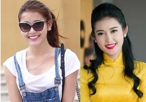 Sau khi làm răng, gương mặt Huyền My có nhiều sự thay đổi.