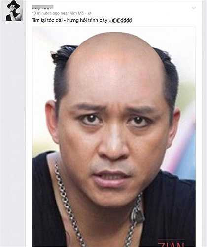 Người hâm mộ động viên Tuấn Hưng 'không phải lo lắng vì tóc sẽ nhanh mọc lại' và 'dù đầu trọc, anh vẫn đẹp trai'. 