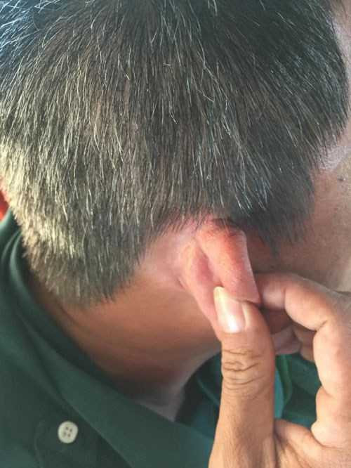 Liều lĩnh ném đá trực diện vào xe khách, tài xế bị thương