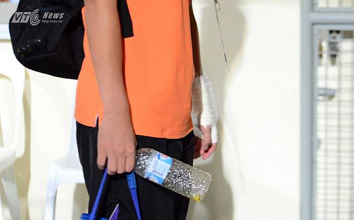 Anh cho biết mình bị đau sau một pha ngã chống tay.