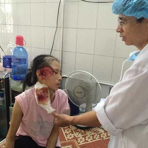 Xin cứu giúp người đàn bà góa bụa ung thư sắp phải khoét xương đầu