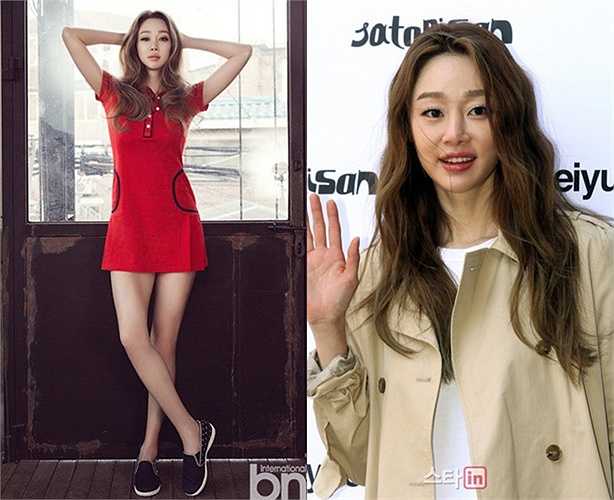Mỹ nhân phim Xin lỗi, anh yêu em Choi Yeo Jin bị ê-kíp tạp chí 'mài' nhẵn đầu gối, đôi chân mất cân bằng với tỷ lệ cơ thể. Ngoài ra gương mặt đậm chất Hàn của Choi Yeo Jin cũng được chỉnh sửa làm mất đi vẻ sống động.