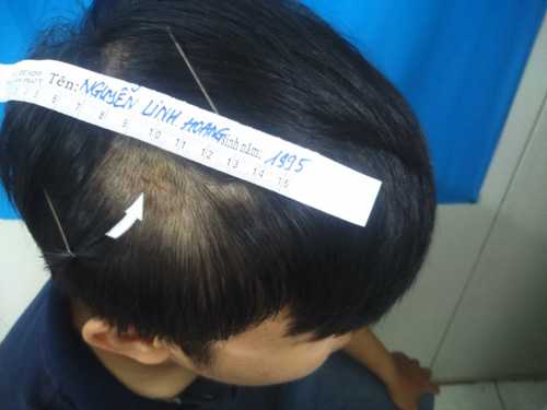 2 phóng viên bị nhóm côn đồ đánh đập: Nhận diện nhóm hung thủ