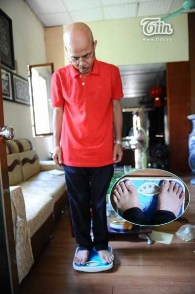 Sau đổ bệnh, anh đã bị sút cân rất nhiều.