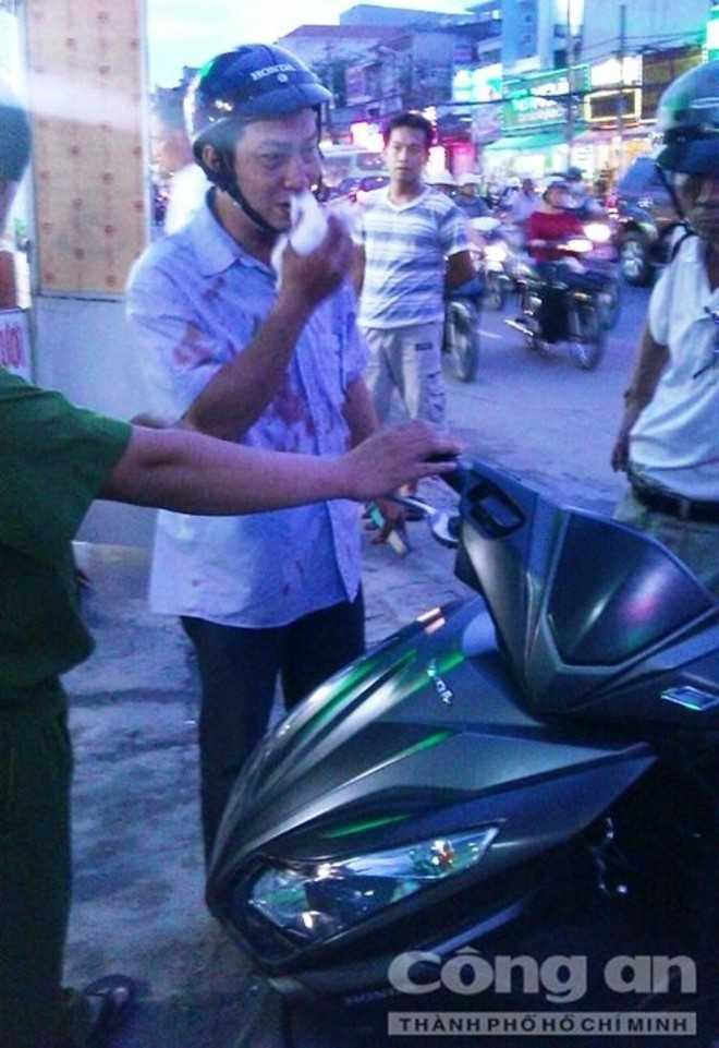 Va chạm giao thông, tài xế taxi đấm gãy mũi người đi xe máy