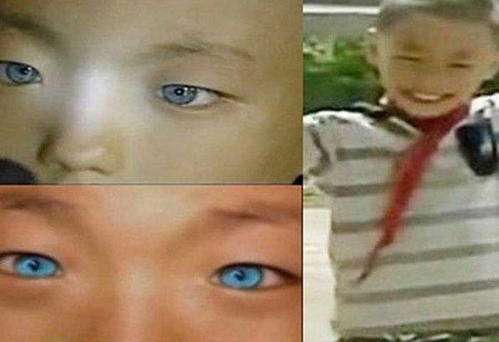 Cậu bé Nong Yousui, sống ở Dhua, Trung Quốc sở hữu đôi mắt có thể nhìn xuyên màn đêm như mèo. Nhiều nhà khoa học cho rằng có thể mắt cậu bé có chứa Tapetum lucidum – một lớp tế bào bao phủ trước màng mắt, tạo ra màu xanh dương trong bóng tối.