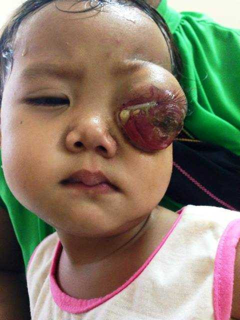 Gia cảnh bi đát của bé gái có đôi mắt ai nhìn cũng quặn lòng xót thương