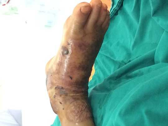 Rắn lục đuôi đỏ tấn công người giữa Sài Gòn, dân bỏ chạy tán loạn