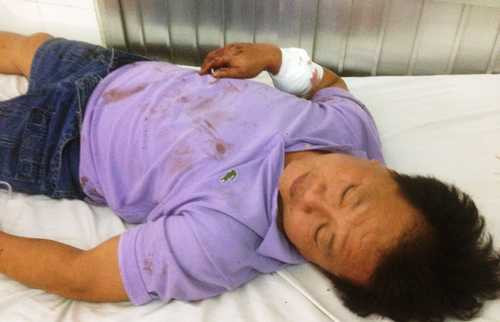 Dân quân phường kéo côn đồ truy sát gia đình người yêu