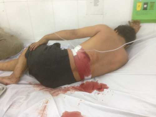 Dân quân phường kéo côn đồ truy sát gia đình người yêu