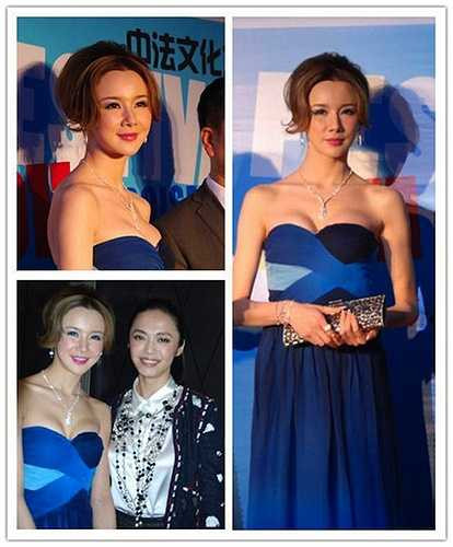 Tôn Phi Phi bị nghi lạm dụng botox khiến gương mặt 'sưng phồng' và mất cân đối. 