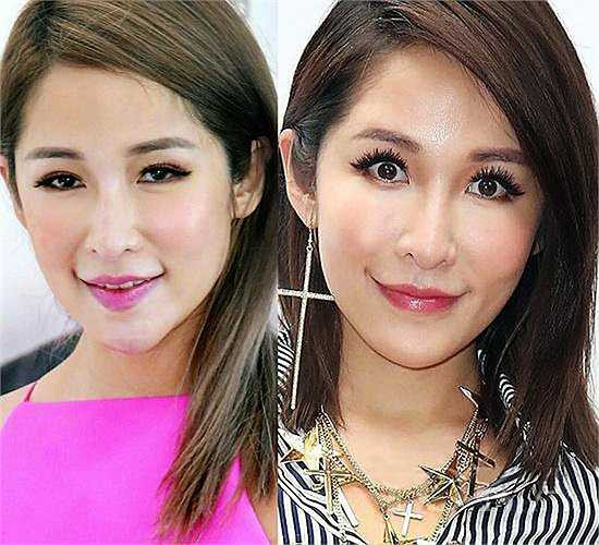 Tiêu Á Hiên cũng chọn giải pháp bơm botox để níu giữ tuổi xuân. 