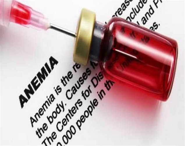 Thiếu máu: Thiếu sắt có thể gây ra rất nhiều vấn đề sức khỏe. Khi bạn thiếu sắt cơ thể gây nhiều tác động khác nhau. Ngoài rụng tóc, da bắt đầu xanh xao, yếu, đau đầu và nhiều vấn đề khác. 